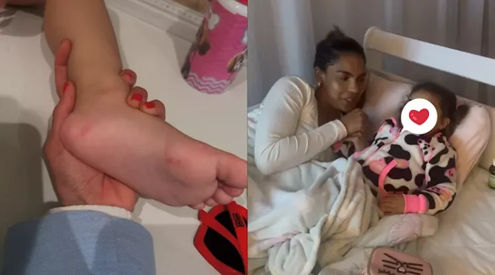 Filha de Tays Reis é Diagnosticada com Mão-Pé-Boca: Entenda a Diferença com a Febre Aftosa em Humanos